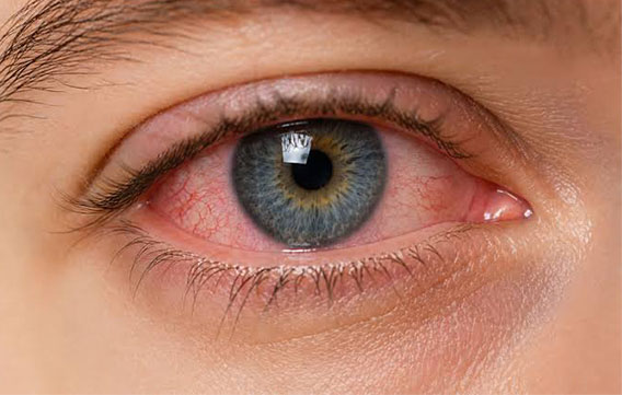 Cornea & Refractive Services